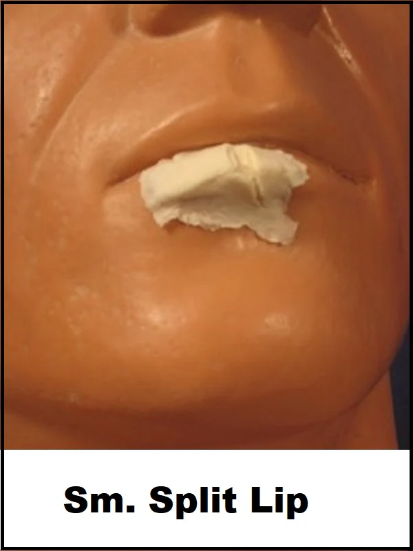 Trauma - Image 3