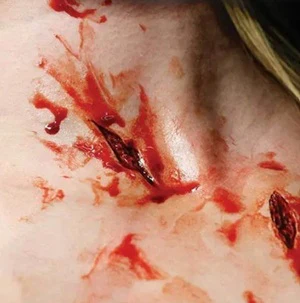 "Shanked" (Stab Wound) - Tinsley Transfers - Image 3